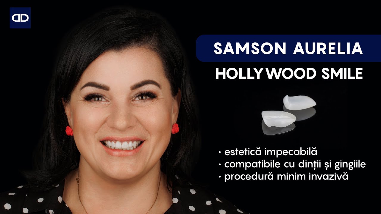 Samson Aurelia fatete dentare