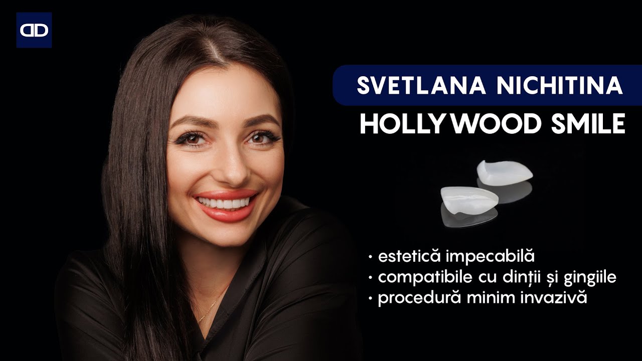 Fațetele dentare cu Svetlana Nichitina