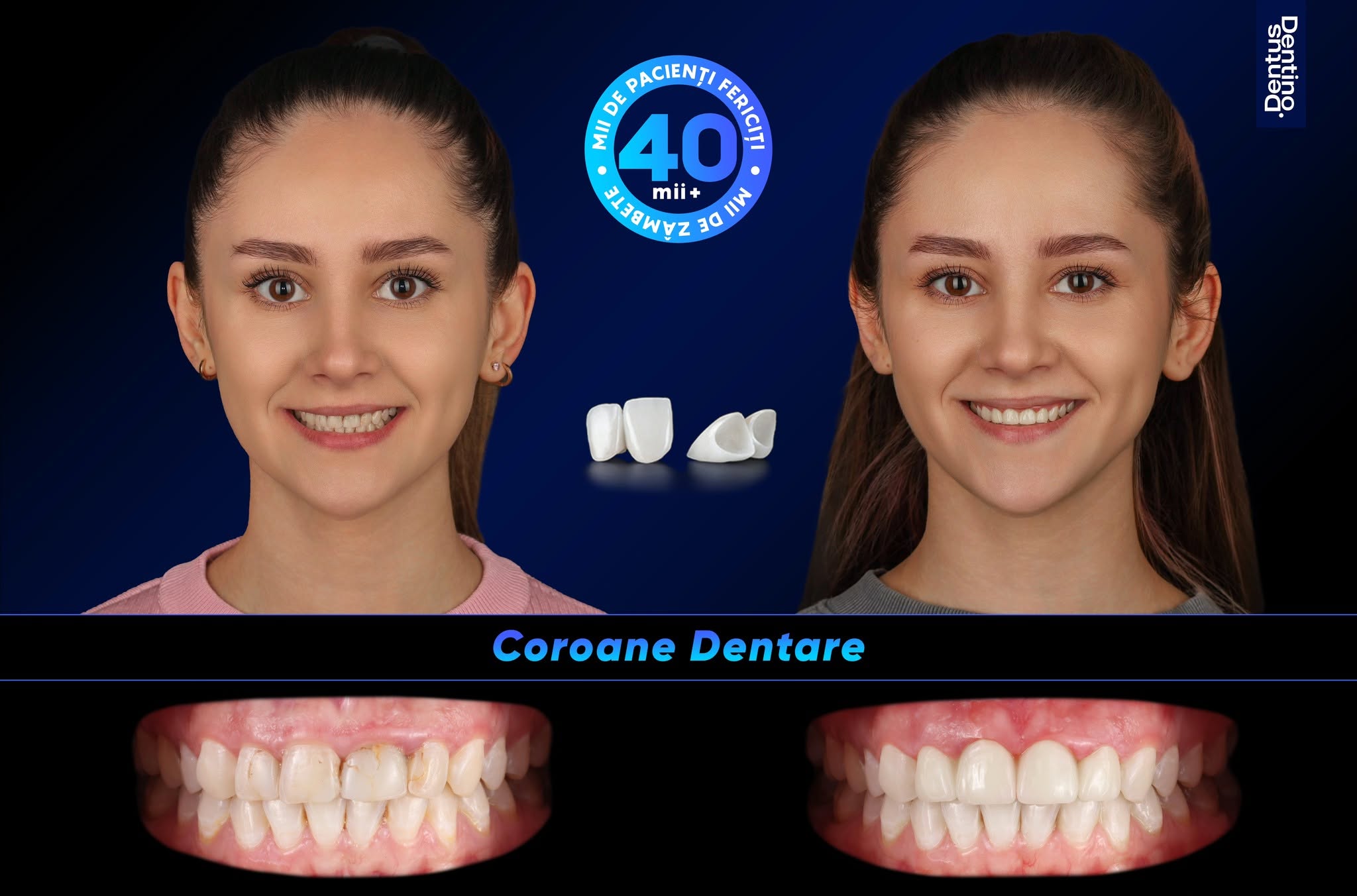coroane clinica stomatologica ciocana botanica centru