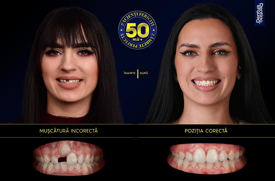 Boico-Paulina-metalici