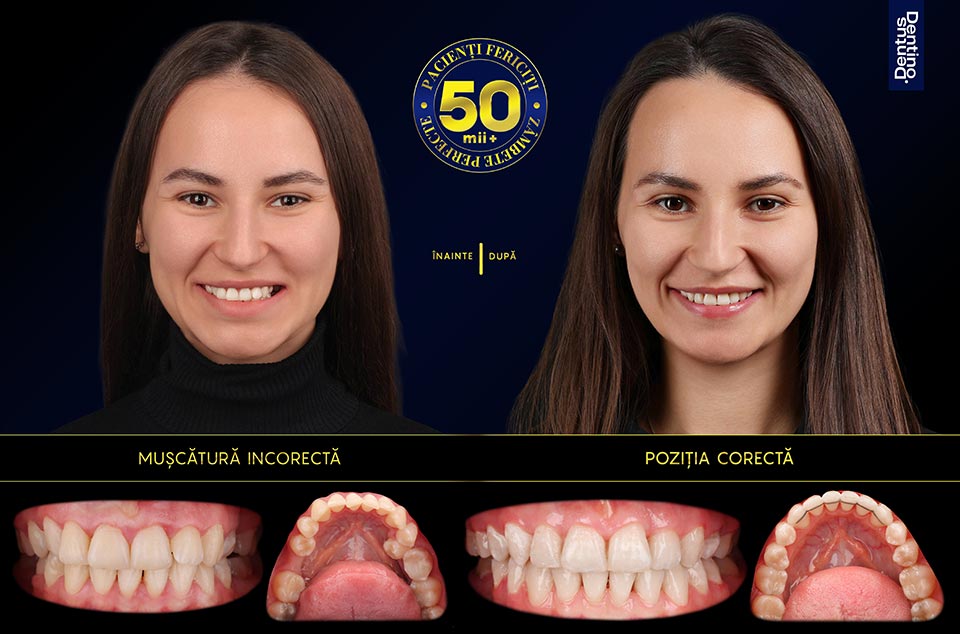 Poiata-Cristina-metalici