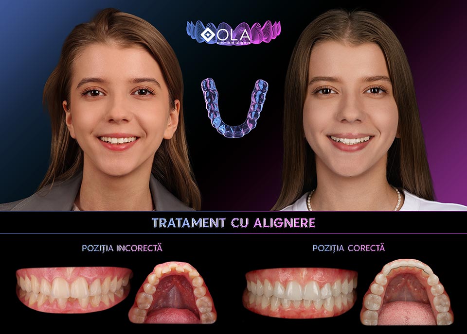 Purici-Adriana-OLA